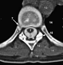 There are three major groups of back muscles:. Thoracic Spine Anatomy Radiology Key