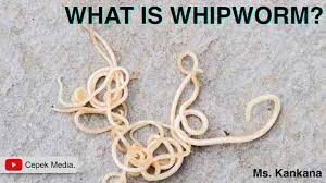 Check spelling or type a new query. What Is Whipworm Biotechnology General Medicine Youtube