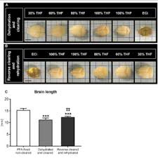 Matthias Gunzer Director Prof Dr Phd University Of Duisburg Essen Essen Uni Due Institute Of Experimental Immunology And Imaging