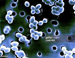 Image result for Group D Streptococcus
