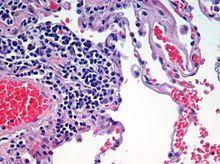 We did not find results for: Tissue Biology Wikipedia
