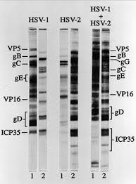 Your test results should be ready within two to five working days, but the timing may vary depending on the clinic or lab. Study Questions Reliability Of Diagnostic Tests For Herpes Newsroom