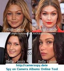 Bella hadid | before and after transformations (plastic surgery rumors, make up, fitness & more)bella hadid and her sister gigi hadid have been in the. Surgery Plastic Before Bella Hadid After Both Gigi Andbefore Before Is The Opposite Of A Kardashian Plastic Surgery Celebrity Surgery Plastic Surgery