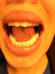 Tongweb On Edge Piercing Tattooing Den Haag That S Me Piercing Health And Wellbeing Tattoos