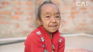 İki yaşlı qız "qoca nənə"yə çevrildi