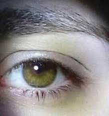 Ela Goz Yesile Doenr Mi Kizlarsoruyor