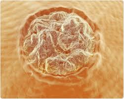 Image result for verrucae filiformes