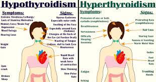 You may experience a stiff neck or other neck discomfort. Our Hormones Can Be Difficult To Deal With At Times But It S Because Of Them That Our Different Bodily Syst Thyroid Disorders Thyroid Symptoms Hyperthyroidism