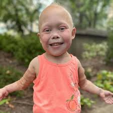 TikTok child star Bella Brave intubated in ICU; family hopes for recovery