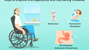 Als, or amyotrophic lateral sclerosis, is a progressive neurodegenerative disease that affects nerve cells in the brain and the spinal cord. What Is Als Progression And Life Expectancy
