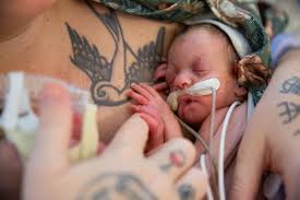 Framtidens vårdpersonal växer hos oss! .🌿 Varje år tar vi på SÄS emot  150–200 elever från vård- och omsorgsutbildningar för arbetsplatsförlagt  lärande (APL). Under fyra veckor får eleverna omsätta sina teoretiska  kunskaper