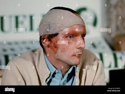 Her head bandaged hi-res stock photography and images