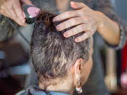 How Long Does It Take For Hair To Grow Back In Various Cases