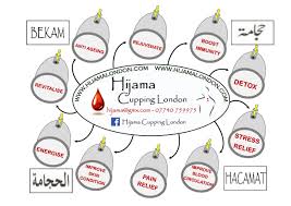Hijama Bekam Hacamat Benefits Chart Hijama Cupping London