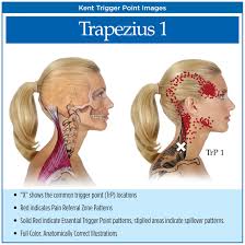 head and neck trigger point chart