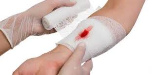 الحلم بان الميت يشتكى عدم الرؤية. Ù…Ø§ ØªÙØ³ÙŠØ± Ø±Ø¤ÙŠØ© Ø§Ù„Ù…ÙŠØª Ù…Ø¬Ø±ÙˆØ­ ÙÙŠ Ø§Ù„Ù…Ù†Ø§Ù… Ù…Ù‚Ø§Ù„