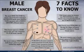 Lung cancer screening refers to testing a healthy individual at high risk for developing lung cancer who has no symptoms of lung cancer to find lung cancer at a stage that it. Cancer In Men Men Need To Know That Lung Cancer Sucks