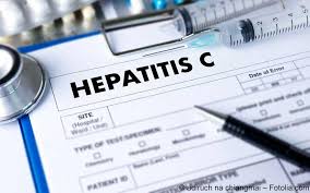 B17.11 acute hepatitis c with hepatic coma; Hepatitis C Symptome Diagnostik Therapie Gelbe Liste