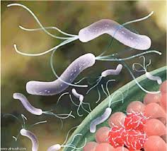 جريدة الرياض دراسة محلية تؤكد أن نسبة الإصابة بجرثومة المعدة بين السعوديين لا تتعدى 37
