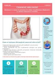 Polipii pe colon, numiți și polipi colorectali, sunt formațiuni celulare care iau naștere pe suprafața colonului, adică intestinul gros, ultima porțiune a tubului digestiv. Arhive Pret Operatie Cancer Colon Dr Gabriel Matei