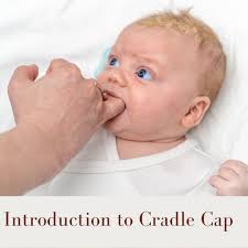 Image result for Cradle Cap
