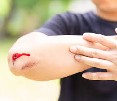 Image result for Wound