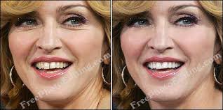 In 1990, after her cover shot for glamour magazine was advised to cover up the gap. Madonna S Front Teeth Gap Closed With Digital Cosmetic Dentistry Http Www Freephotoediting Com Samples Teeth Gap C Gap Teeth Cosmetic Dentistry Perfect Teeth