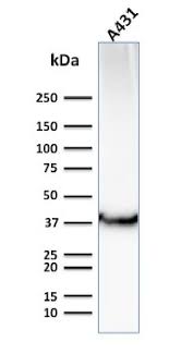 mesothelioma cells show strong cytoplasmic heg1 staining (d). Anti Glut 1 Monoclonal Antibody Clone Glut1 2476