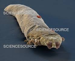 Image result for Demodex folliculorum