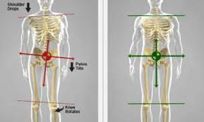 Arefa cassoobhoy on webmd says that pinched nerves in your lumbar region can cause soreness if you stand in one place for a long time, getting up off a chair, or bending over. Lower Back Pain Online Clinic The Fit And Well Club