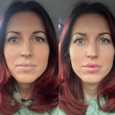 Aura Aesthetics Sussex