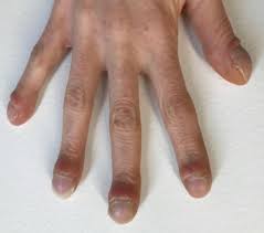 Image result for Digital Clubbing