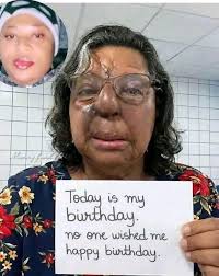 It's my birthday, but no one wishes me, because they see my physical  imperfection.