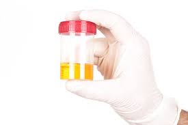You Can Train Yourself To Pee Less Often And 8 Other Surprising Facts About Urine Vox