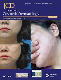 Efficacy and Safety of Topical Compound Heparin Sodium Allantoin Gel (Main  Components: Onion Extract Quercetin) for the Treatment of Rosacea