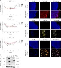 Greene, whose net worth is $3 billion, also owns a $12.5 million malibu mansion, plus a. Influenza A Virus Triggered Autophagy Decreases The Pluripotency Of Human Induced Pluripotent Stem Cells Cell Death Disease