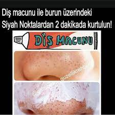 Evet Arkadaslar Yine En Cok Sikayetci Oldugunuz Burun Uzerindeki Siyah Noktalara Pratik Siyah Noktalar Siyah Evde Hazirlabilen Ilaclar