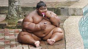 La Tragica Vida De Arya Permana El Nino Mas Gordo Del Mundo Que Pesa 200 Kilos