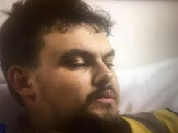 Stoke-on-Trent dad, 26, feared he would die after cutting arm in two with  circular saw