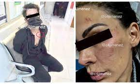 El actor eleazar gómez vive en un aprtamento de la ciudadde méxico. Revelan Fotos De Las Agresiones Que Eleazar Gomez Le Hizo A Stephanie Valenzuela Futbol Rf