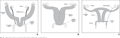 There have been rare reports of mmmt of the uterus developing in individuals with lynch syndrome, an inherited condition in which individuals have a genetic predisposition to develop certain cancers including uterine cancer. Figure 2 From Mri Of Pregnancy Related Issues Mullerian Duct Anomalies Semantic Scholar