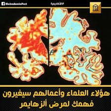 الخرف الكهلي أو ألزهايمر إذا أردنا أن نكون أكثر لطفا هو بحسب الأبحاث السبب الأكثر شيوعا للخرف نبدأ المقال بجائزة قدرها ملي Arabic Calligraphy Calligraphy Art