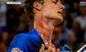 Select from premium benjamin pavard of the highest quality. Benjamin Pavard Left With Shocking Neck Wounds After Antonio Rudiger Stamp