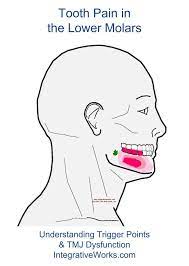 Pin On Tooth And Sinus Trigger Point Pain