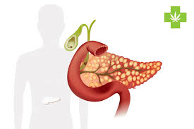 Signs and symptoms of pancreatitis include pain in the upper abdomen, nausea and vomiting. Cannabinoidi Per Alleviare La Pancreatite Acuta Kalapa Clinic
