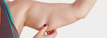 Dieting can cause you to lose weight in your upper body without changing the areas affected by lipedema.symptoms of lipedema include: Arm Lift Fer Clinic