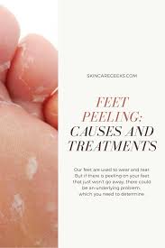 Bottom Of Feet Peeling Causes And Treatments In 2020 Itchy Peeling Skin Dermatology Skin Care Peeling Skin