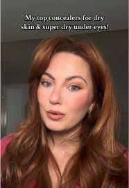 Top Concealers for Dry and Eczema-Prone Skin