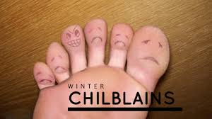 Image result for Chilblains