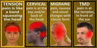 Tension Headaches Tension Headache Remedial Massage Headache